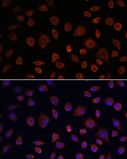 Immunofluorescence analysis of L929 cells using ULk1 Polyclonal Antibody at dilution of  1:100. Blue: DAPI for nuclear staining.