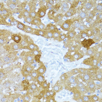 Immunohistochemistry of paraffin-embedded Mouse liver using ULk1 Polyclonal Antibody at dilution of  1:100 (40x lens).