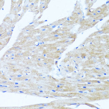 Immunohistochemistry of paraffin-embedded Mouse heart using ULk1 Polyclonal Antibody at dilution of  1:100 (40x lens).