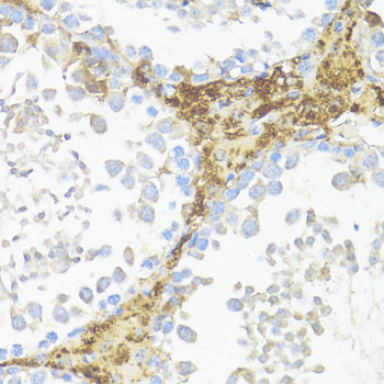 Immunohistochemistry of paraffin-embedded Mouse leydig cells using AMH Polyclonal Antibody at dilution of  1:100 (40x lens).