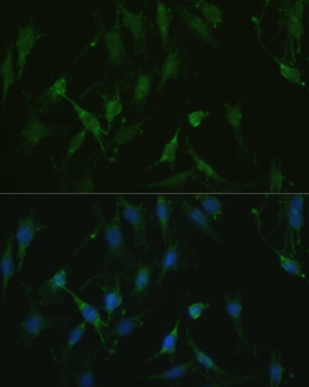 Immunofluorescence analysis of C6 cells using TRPV1 Polyclonal Antibody at dilution of  1:100. Blue: DAPI for nuclear staining.