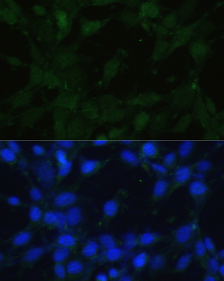 Immunofluorescence analysis of NIH/3T3 cells using TRPV1 Polyclonal Antibody at dilution of  1:100. Blue: DAPI for nuclear staining.