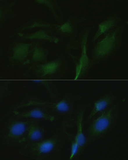 Immunofluorescence analysis of U2OS cells using TRPV1 Polyclonal Antibody at dilution of  1:100. Blue: DAPI for nuclear staining.