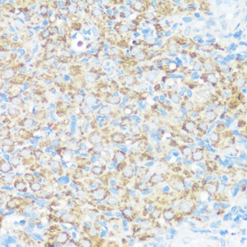 Immunohistochemistry of paraffin-embedded Rat ovary using NMT1 Polyclonal Antibody at dilution of  1:100 (40x lens).