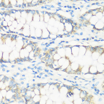 Immunohistochemistry of paraffin-embedded Human colon using NMT1 Polyclonal Antibody at dilution of  1:100 (40x lens).