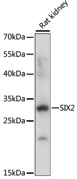 Western blot analysis of extracts of Rat kidney using SIX2 Polyclonal Antibody at dilution of 1:1000.