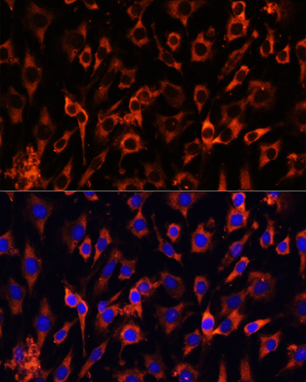 Immunofluorescence analysis of C6 cells using MCTS1 Polyclonal Antibody at dilution of  1:100 (40x lens). Blue: DAPI for nuclear staining.