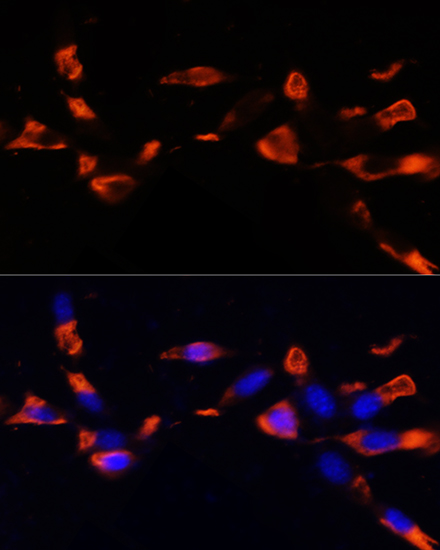 Immunofluorescence analysis of NIH/3T3 cells using MCTS1 Polyclonal Antibody at dilution of  1:100 (40x lens). Blue: DAPI for nuclear staining.