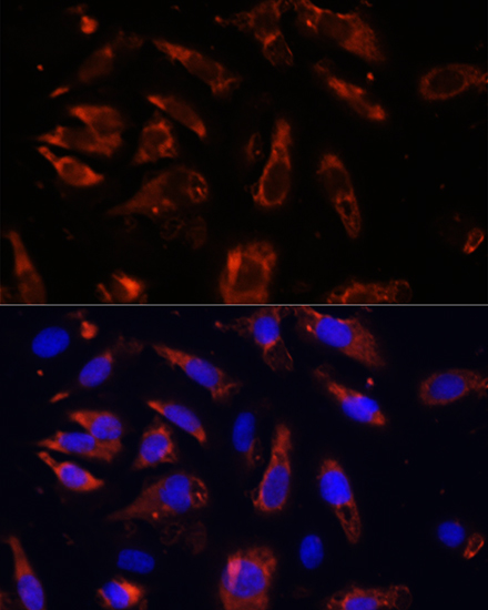 Immunofluorescence analysis of U-2OS cells using MCTS1 Polyclonal Antibody at dilution of  1:100 (40x lens). Blue: DAPI for nuclear staining.