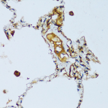 Immunohistochemistry of paraffin-embedded Human lung using C1QC Polyclonal Antibody at dilution of  1:100 (40x lens).