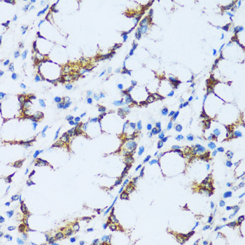 Immunohistochemistry of paraffin-embedded Human colon using C1QC Polyclonal Antibody at dilution of  1:100 (40x lens).