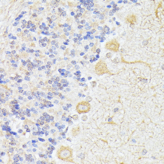 Immunohistochemistry of paraffin-embedded Rat cerebellum using ELP3 Polyclonal Antibody at dilution of  1:100 (40x lens).