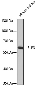 Western blot analysis of extracts of Mouse kidney using ELP3 Polyclonal Antibody at dilution of 1:1000.