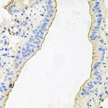 Immunohistochemistry of paraffin-embedded Mouse lung using HPR Polyclonal Antibody at dilution of  1:100 (40x lens).