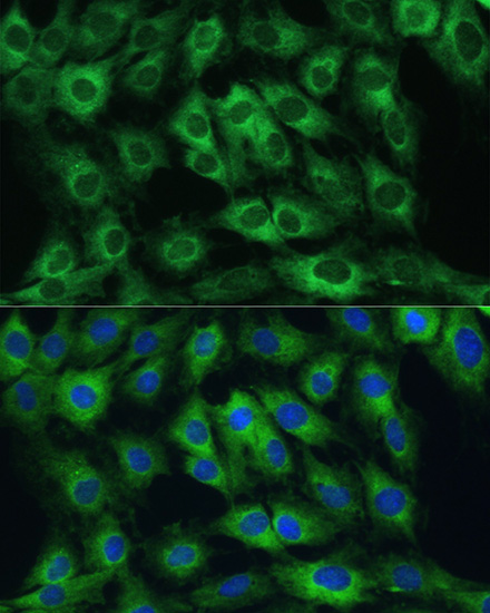 Immunofluorescence analysis of C6 cells using FRMD6 Polyclonal Antibody at dilution of  1:100. Blue: DAPI for nuclear staining.