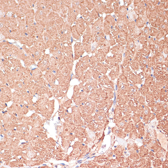 Immunohistochemistry of paraffin-embedded Rat heart using FRMD6 Polyclonal Antibody at dilution of  1:100 (40x lens).