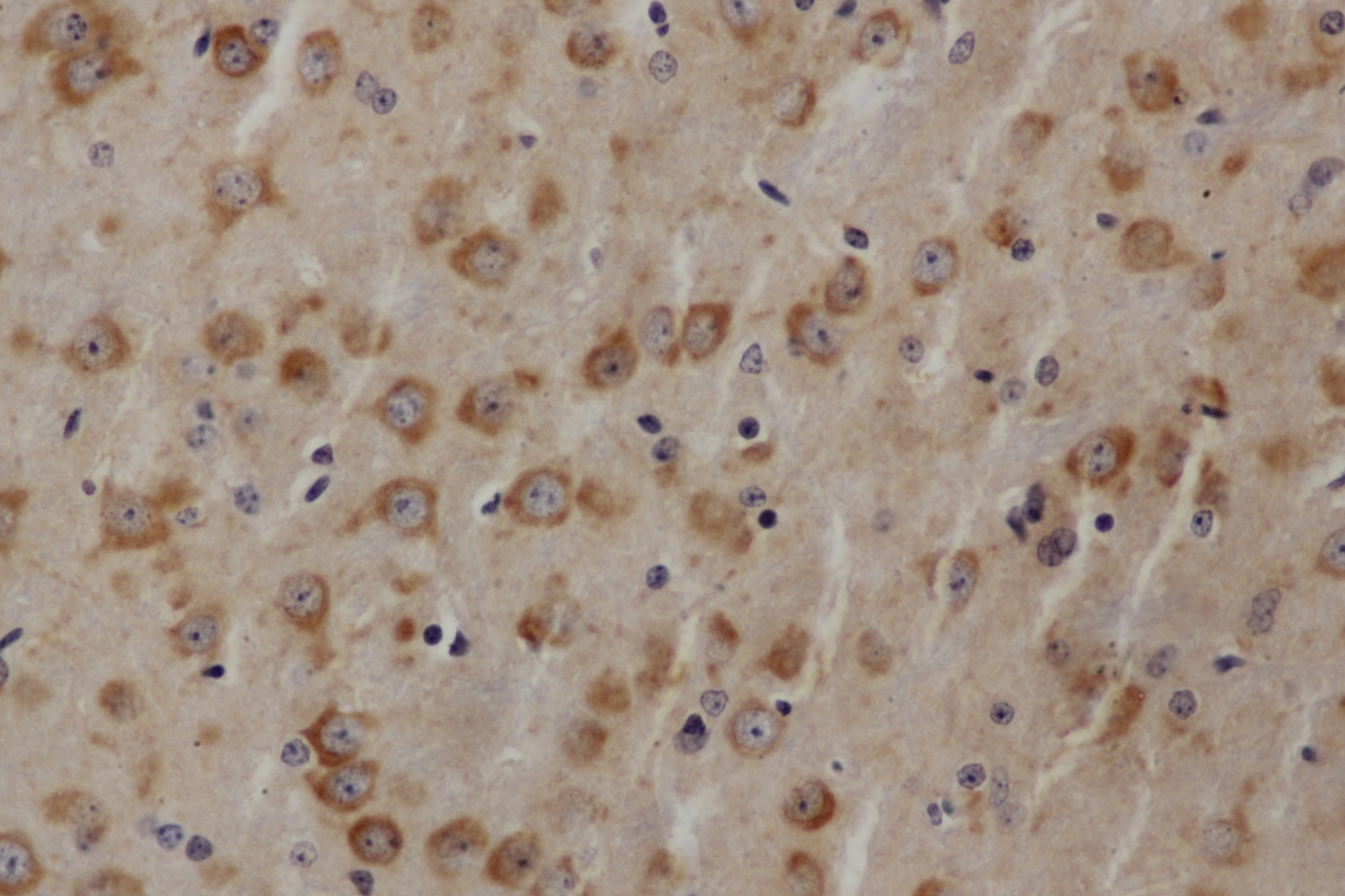 Immunohistochemistry of paraffin-embedded Mouse brain using AKT1 Polyclonal Antibody at dilution of 1:50