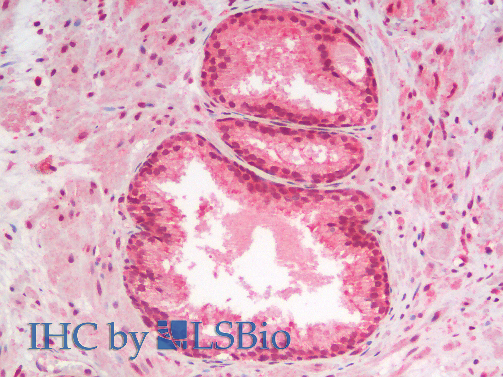 Immunohistochemistry analysis of paraffin-embedded Human Prostate using AKT1 Polyclonal Antibody.