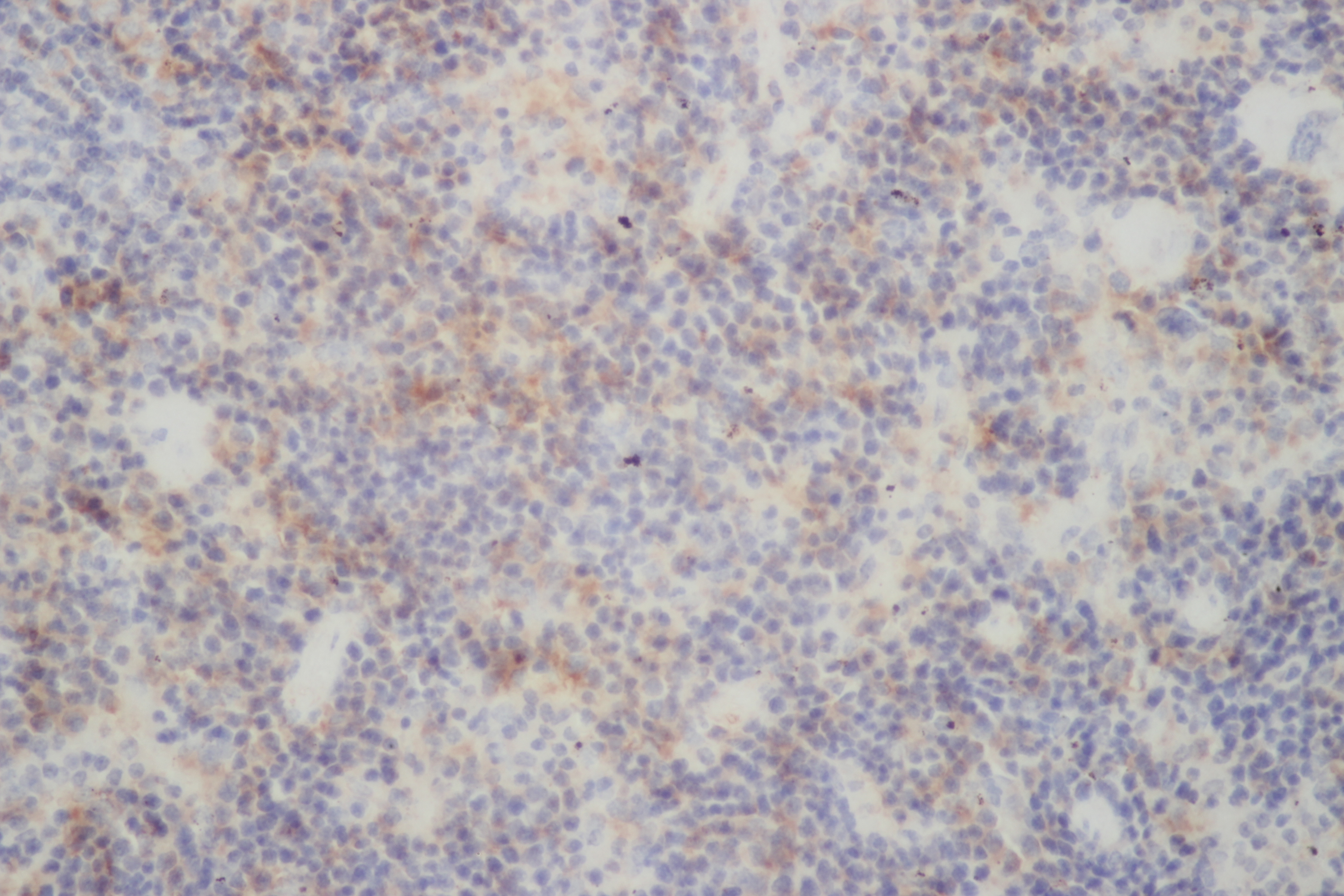 Immunohistochemistry of paraffin-embedded Rat spleen using RELB Polyclonal Antibody at dilution of 1:50