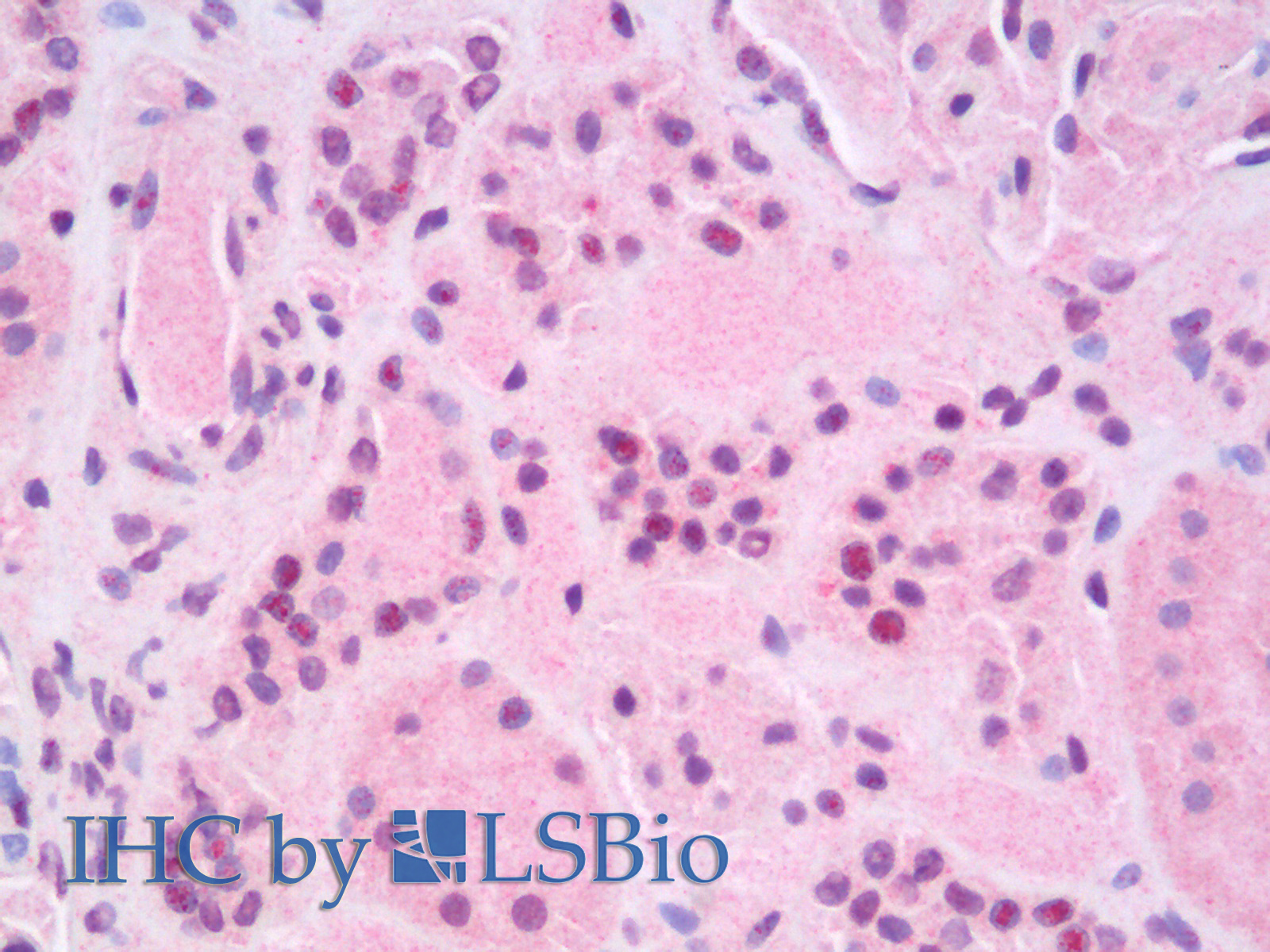 Immunohistochemistry analysis of paraffin-embedded Human Kidney using RELB Polyclonal Antibody.