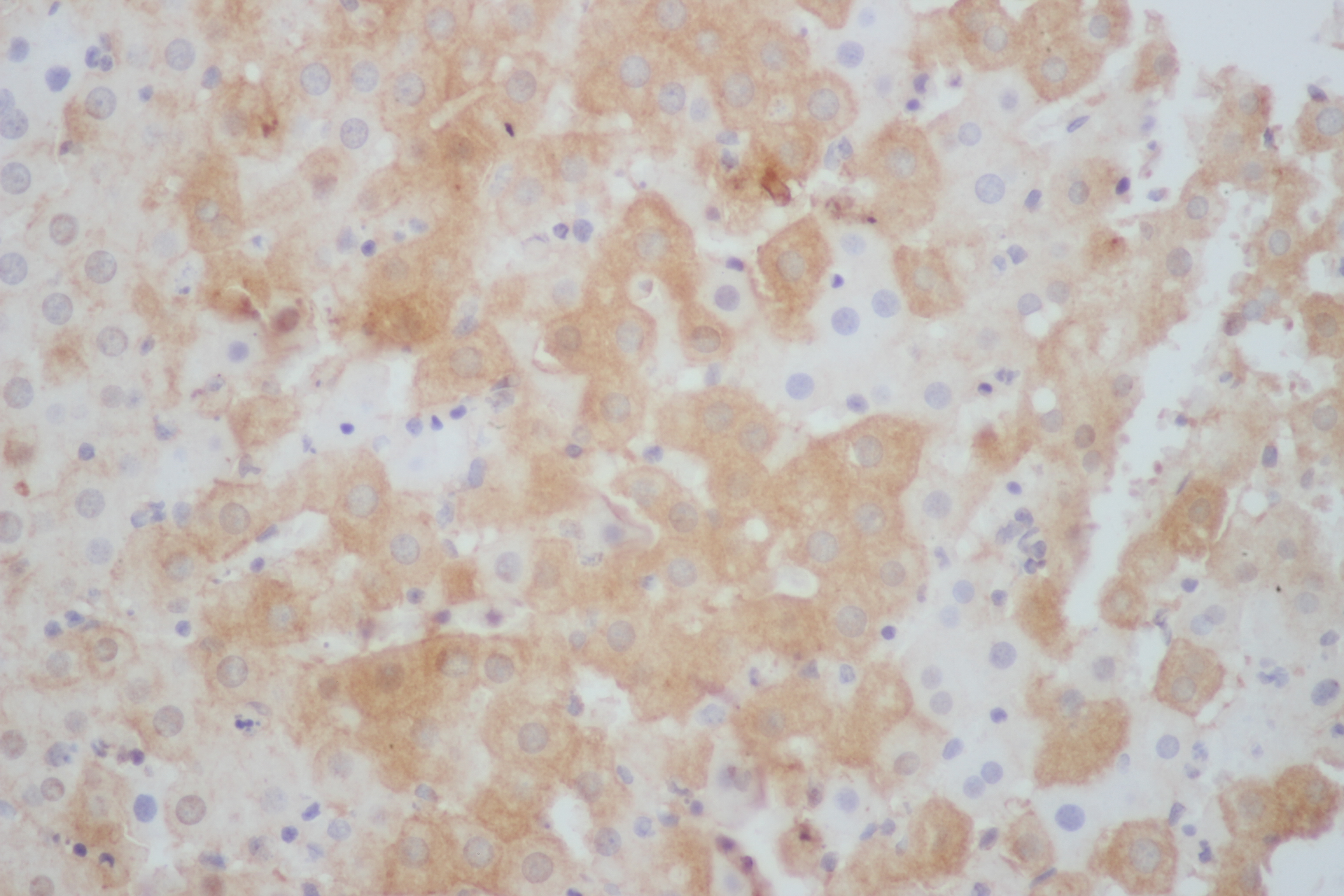 Immunohistochemistry of paraffin-embedded Rat liver using STAT1 Polyclonal Antibody at dilution of 1:50