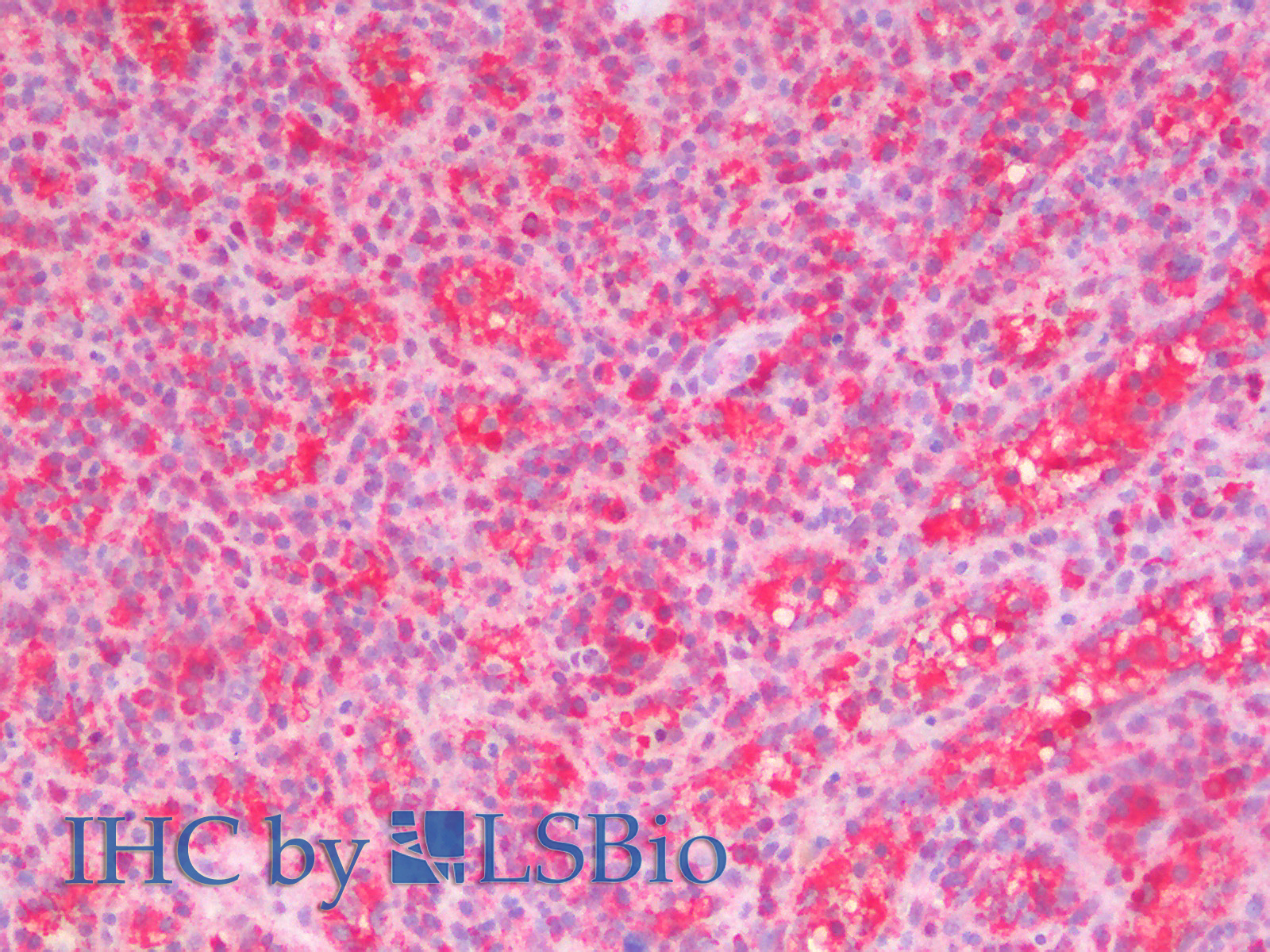 Immunohistochemistry analysis of paraffin-embedded Human Spleen using STAT1 Polyclonal Antibody.