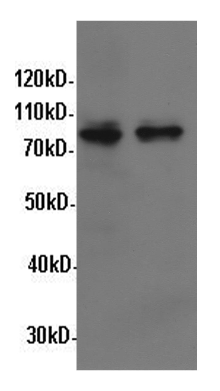 Western Blot analysis of Hela and A549 cells using STAT1 Polyclonal Antibody at dilution of 1:600