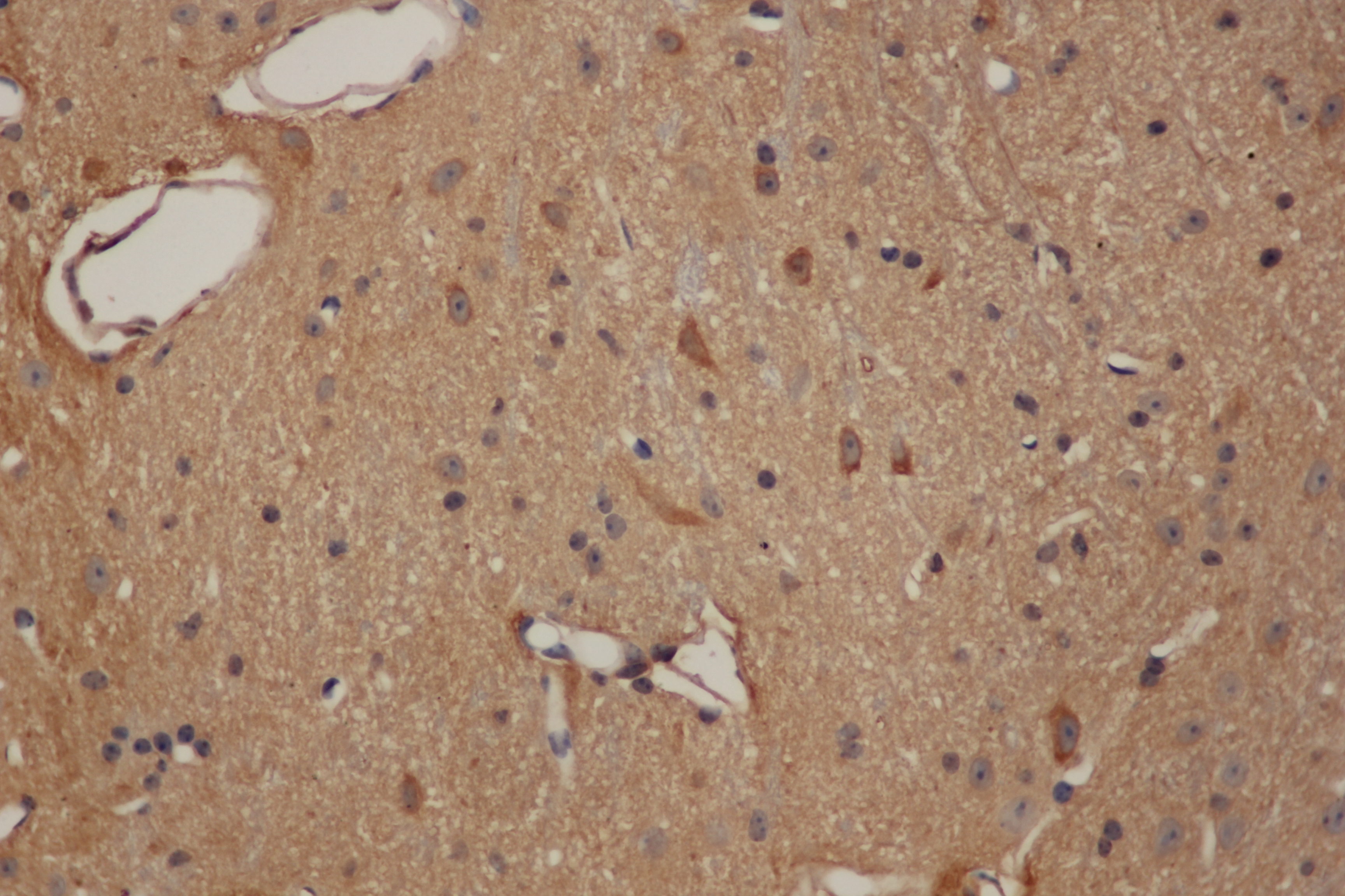 Immunohistochemistry of paraffin-embedded Mouse brain using ENO1 Polyclonal Antibody at dilution of 1:50