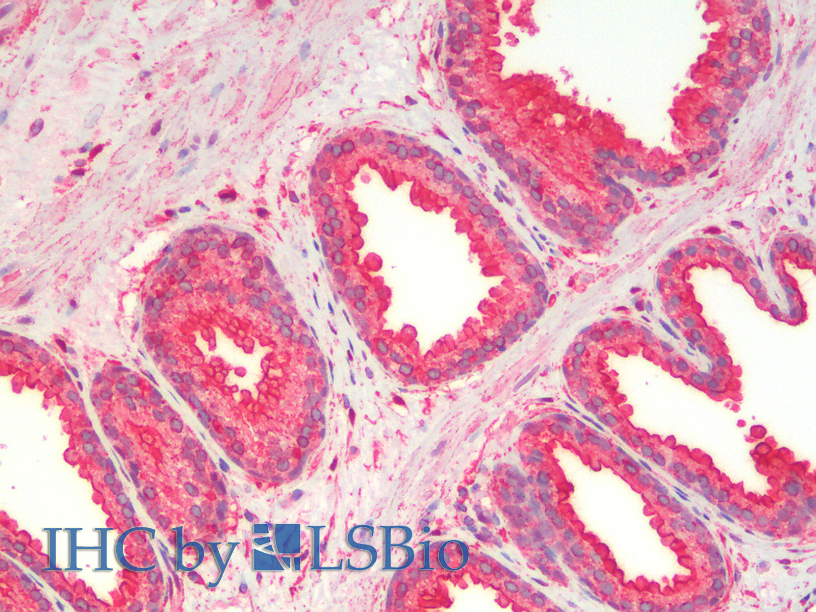 Immunohistochemistry analysis of paraffin-embedded Human Prostate using ANXA5 Polyclonal Antibody.