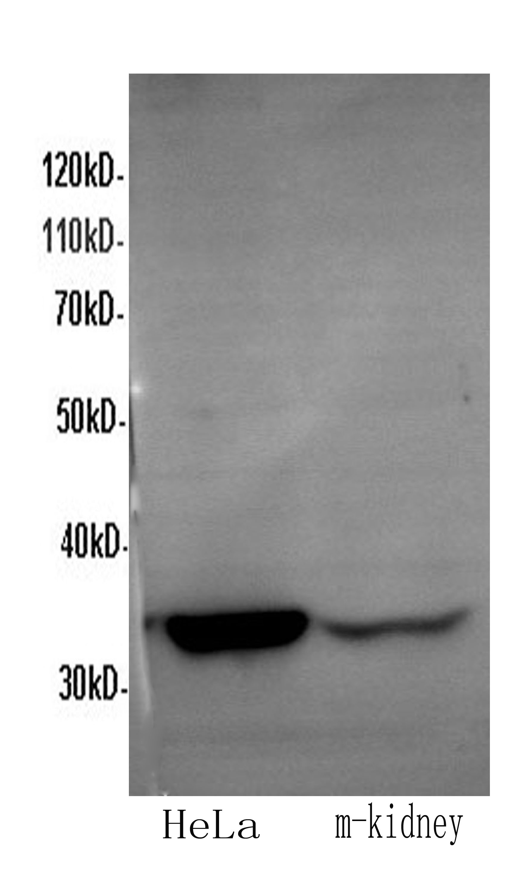 Western Blot analysis of HeLa and Mouse kidney using ANXA5 Polyclonal Antibody at dilution of 1:600