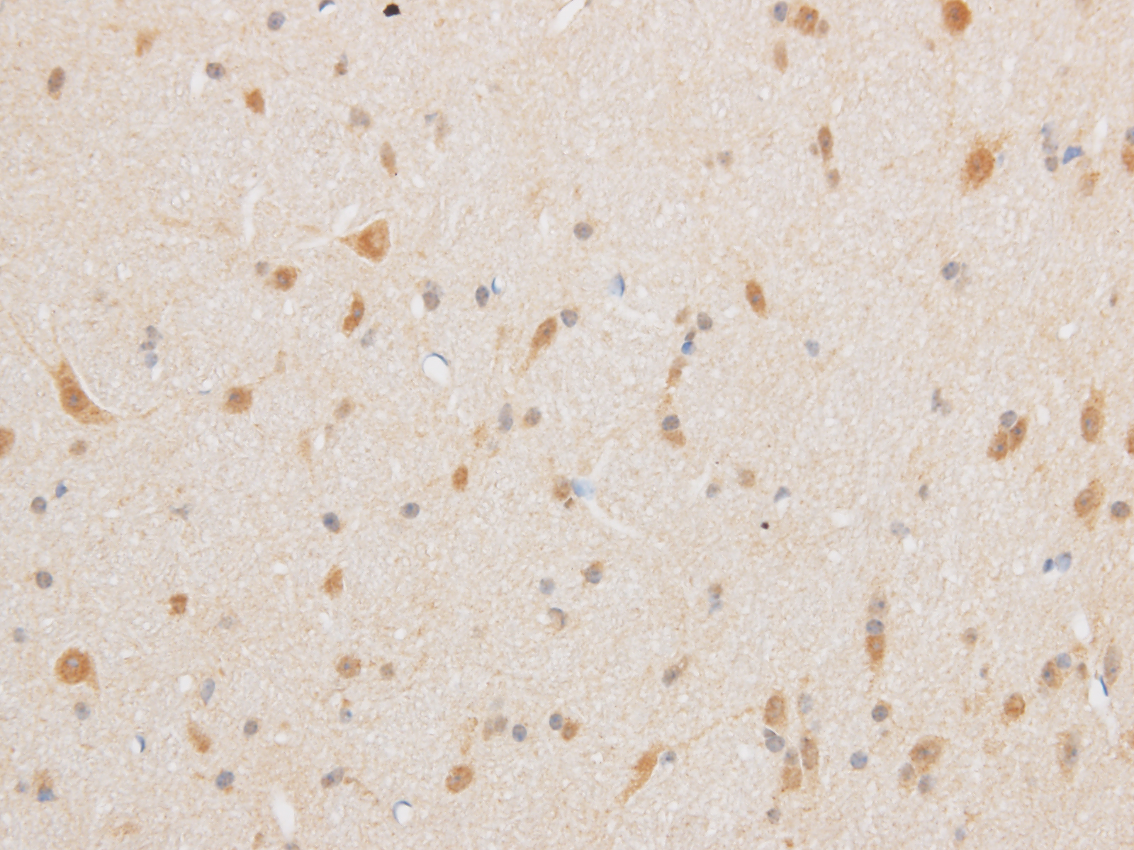 Immunohistochemistry of paraffin-embedded Mouse brain using TRIP4 Polyclonal Antibody at dilution of 1:50