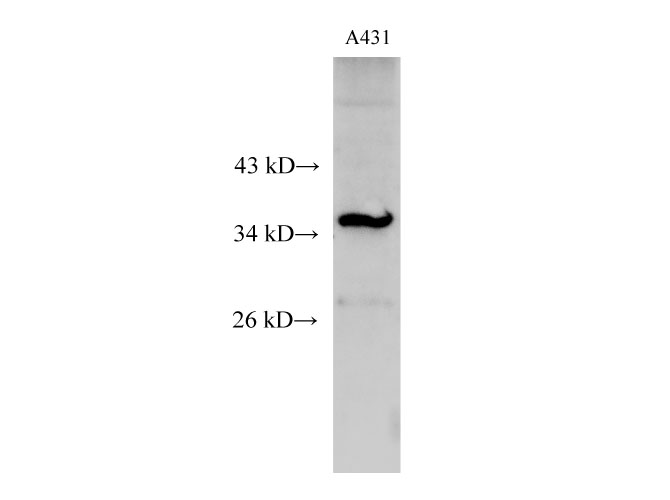 Western Blot analysis of A431 cell using C15orf23 Polyclonal Antibody at dilution of 1:500