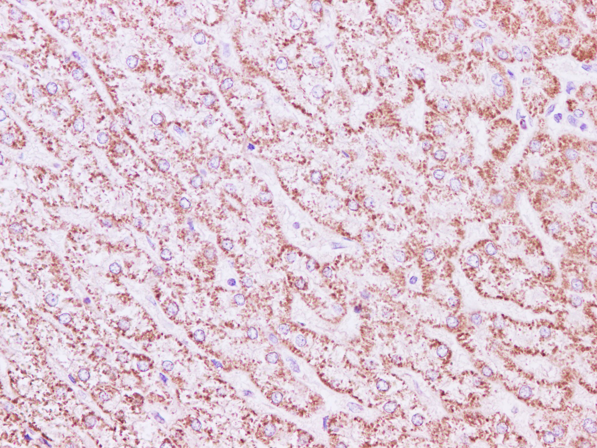 Immunohistochemistry of paraffin-embedded Human liver tissue using SDHA Polyclonal Antibody at dilution of 1:200