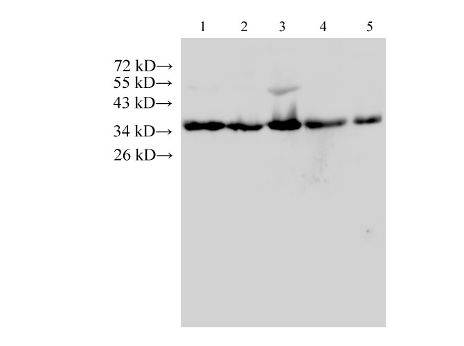 Western Blot analysis of Hela, A431, HepG2, k562 and Raw264.7 cells using ANXA5 Polyclonal Antibody at dilution of 1:500