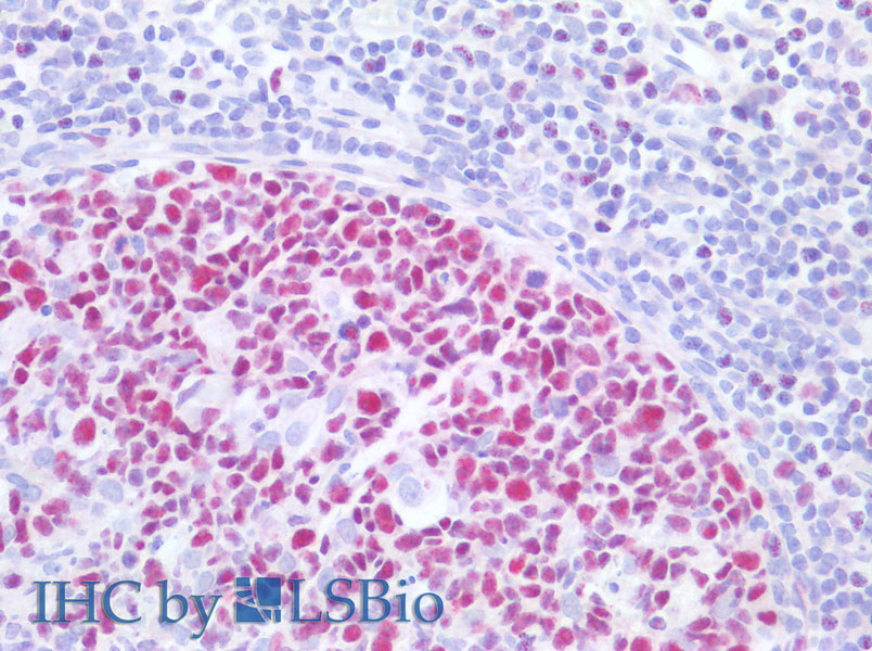 Immunohistochemistry of paraffin-embedded Human tonsil using MCM3 Polyclonal Antibody at dilution of 1:200.