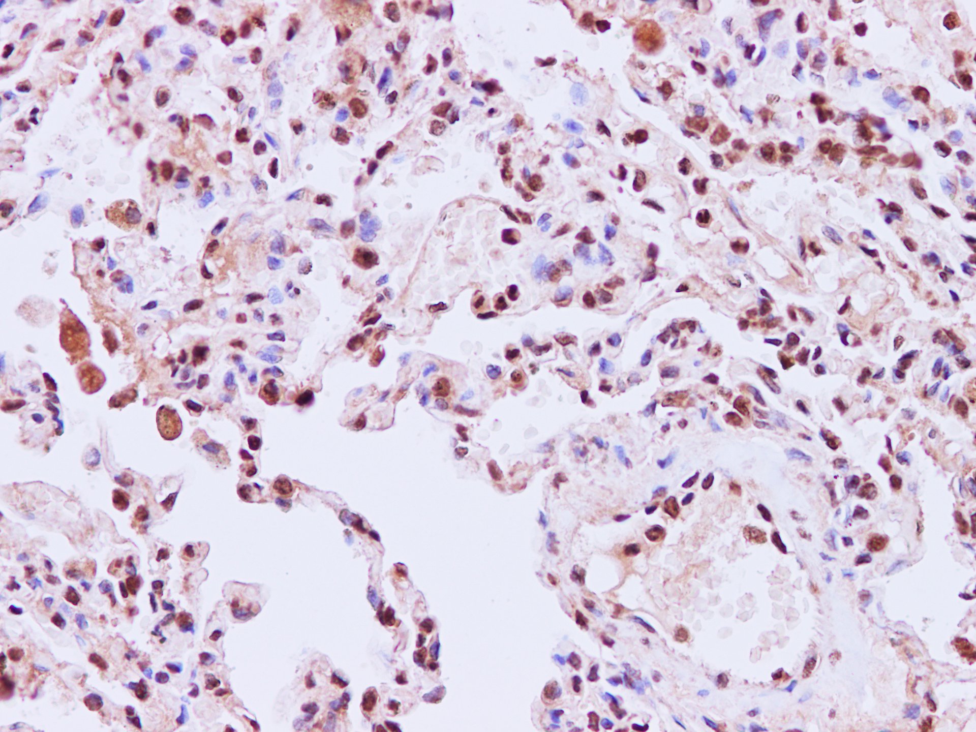 Immunohistochemistry of paraffin-embedded Human lung using STIL Polyclonal Antibody at dilution of 1:200