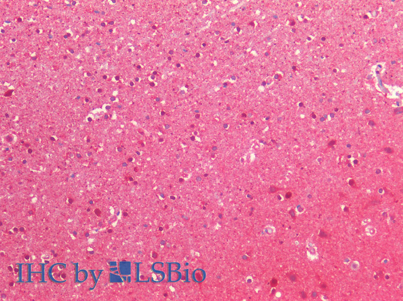 Immunohistochemistry of paraffin-embedded Human cerebral cortex using NEDD8 Polyclonal Antibody at dilution of 1:200.