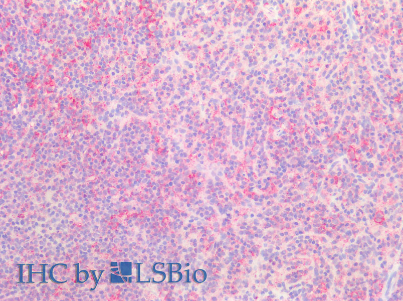 Immunohistochemistry of paraffin-embedded Human spleen using SNAP23 Polyclonal Antibody at dilution of 1:200.