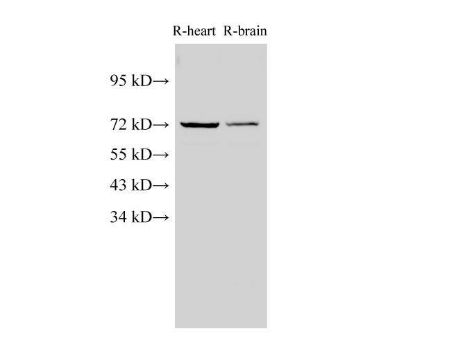 Western Blot analysis of Rat heart and Rat brain using Lamin B1 Polyclonal Antibody at dilution of 1:1000