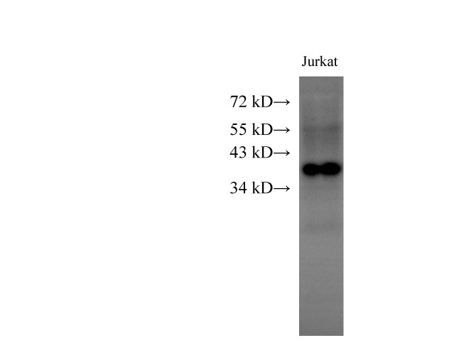 Western Blot analysis of Jurkat cells using HMG20B Polyclonal Antibody at dilution of 1:1000