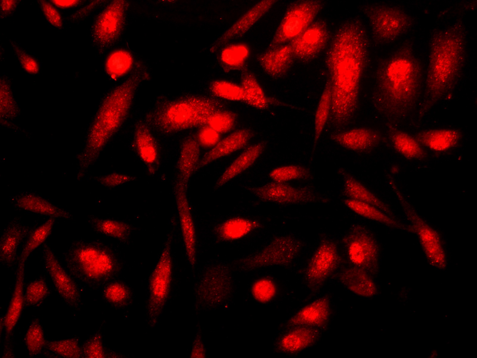 Immunofluorescence analysis of PC-3 cells  using p16 Polyclonal Antibody at dilution of 1:100