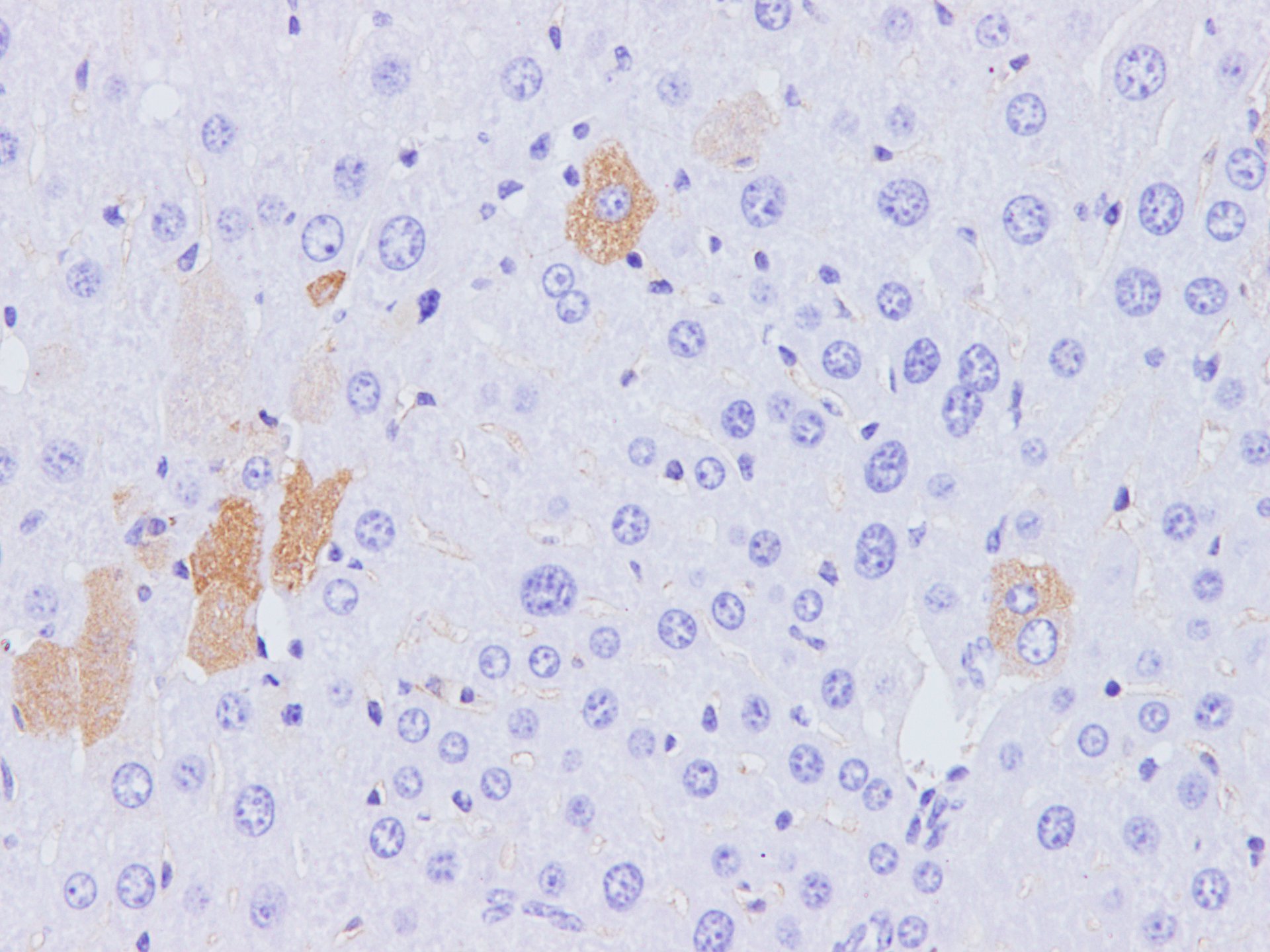 Immunohistochemistry of paraffinembedded Rat liver using p16 Polyclonal Antibody at dilution of 1:100
