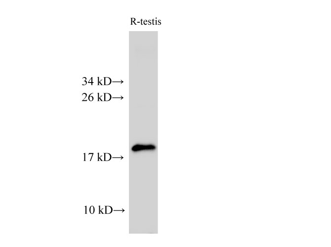 Western Blot analysis of Rat testis using Ak6 Polyclonal Antibody at dilution of 1:2000