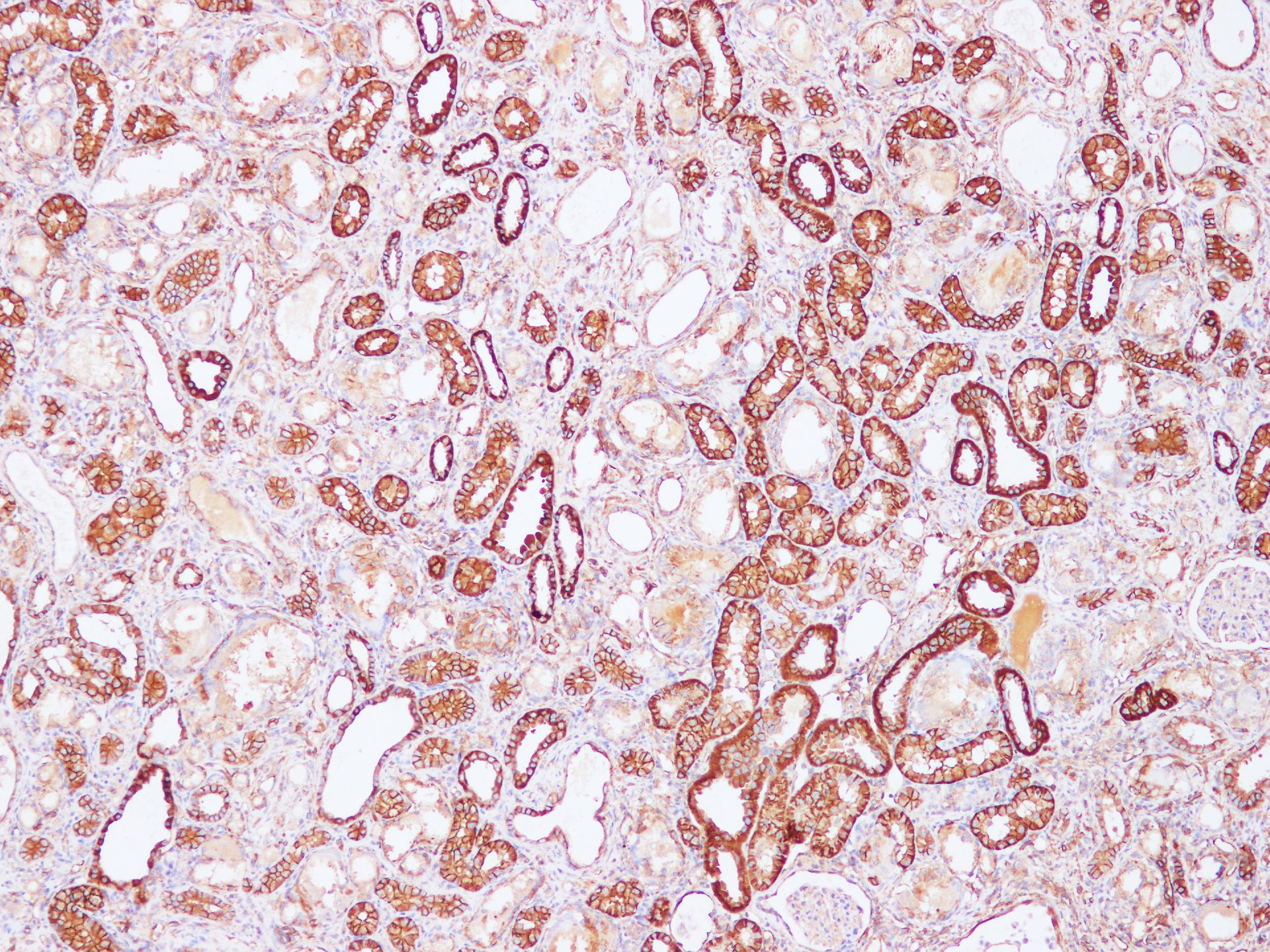 Immunohistochemistry of paraffin-embedded Rat kidney using Sptan1 Polyclonal Antibody at dilution of 1:100(100×)