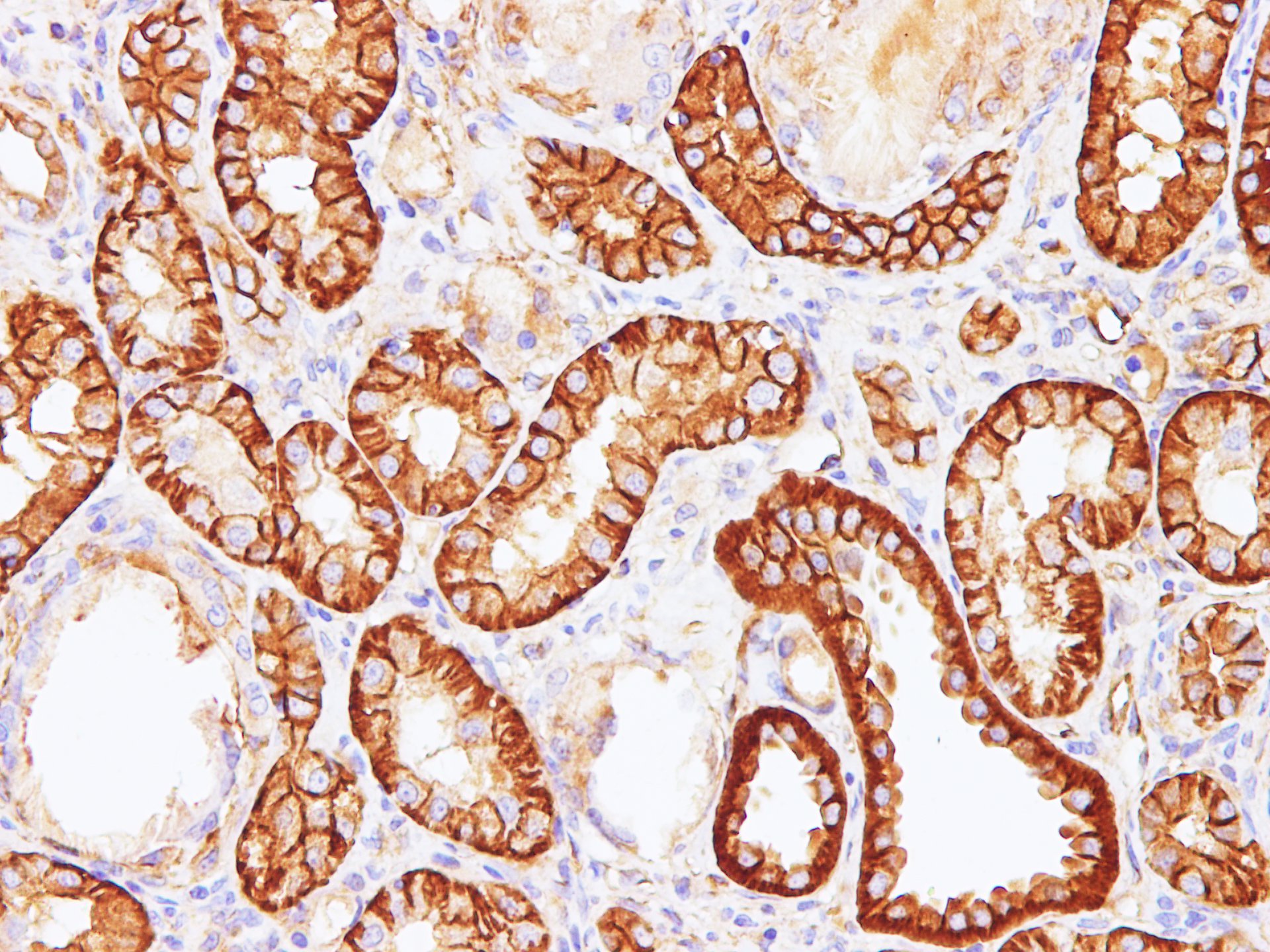 Immunohistochemistry of paraffin-embedded Rat kidney using Sptan1 Polyclonal Antibody at dilution of 1:100(400×)