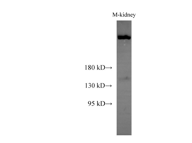 Western Blot analysis of Mouse kidney using Sptan1 Polyclonal Antibody at dilution of 1:1000