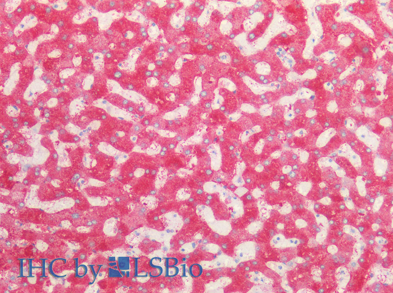 Immunohistochemistry of paraffin-embedded Human liver using PCK1 Polyclonal Antibody at dilution of 1:100.