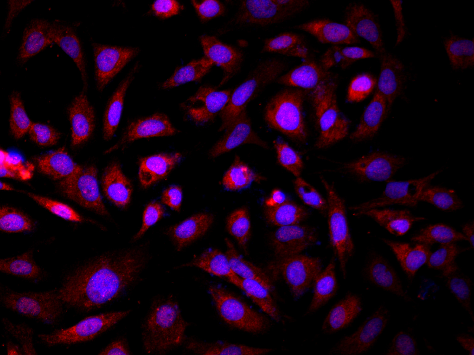 Immunofluorescence analysis of HepG2 cells using GCK Polyclonal Antibody at dilution of 1:100