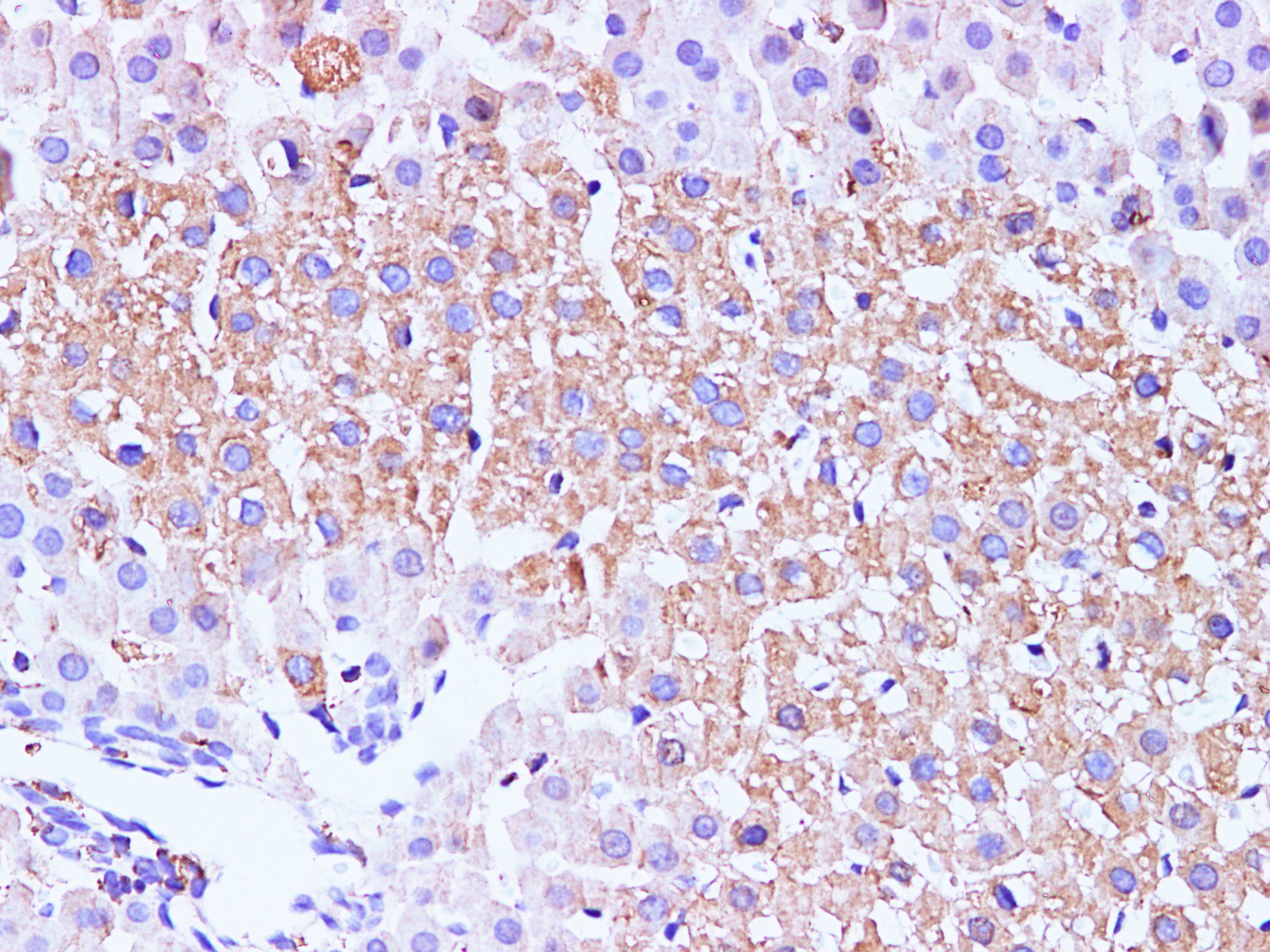 Immunohistochemistry of paraffin-embedded Mouse liver using GCK Polyclonal Antibody at dilution of 1:100