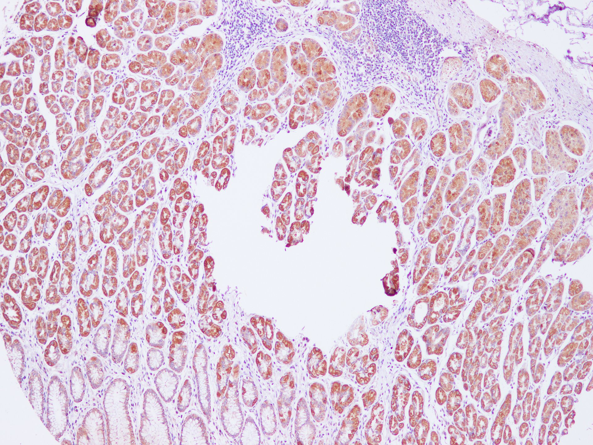 Immunohistochemistry of paraffin-embedded Human stomach using Cytochrome c1 Polyclonal Antibody at dilution of 1:100(100×)